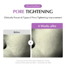 سرم کنترل منافذ PDRN بنفش اکوال بری EQQUALBERRY Purple PDRN Pore Minimizing Serum وگان کره‌ای برای بستن منافذ و کنترل چربی پوست
