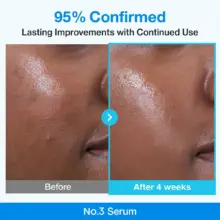 “سرم بایو-رتینول آبی نامبوزین شماره W - کوچک‌کننده منافذ پوست و بهبود دهنده بافت با 10% نیاسینامید - محصول اصل کره‌ای”