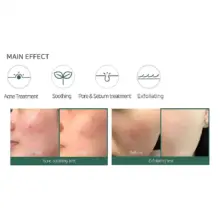 فوم ضد جوش لایه بردار میراکل سام بای می SOME BY MI AHA BHA PHA 30 Days Miracle Acne Clear Foam 100ml