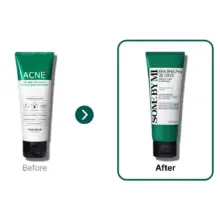 فوم ضد جوش لایه بردار میراکل سام بای می SOME BY MI AHA BHA PHA 30 Days Miracle Acne Clear Foam 100ml