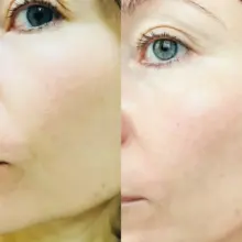 فوم ژل شستشوی صورت بایودرما سنسیبیو Bioderma Sensibio Gel Moussant برای پوست حساس و خشک