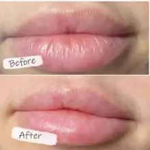 ماسک لب شب توت فرنگی لانیژ Laneige Lip Sleeping Mask EX Berry با ویتامین C، کره شی و کمپلکس توت برای آبرسانی، ترمیم و نرمی لب‌های خشک 20 گرم