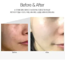 کرم تسکین دهنده و ترمیم کننده سنتلا مدی پیل Medi-Peel Centella Mezzo Cream 30ml