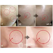 کرم تسکین دهنده و ترمیم کننده سنتلا مدی پیل Medi-Peel Centella Mezzo Cream 30ml