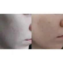 یست-تونر-ضد-لک-و-روشن-کننده-نیاسینامید-تیام-TIAM-Vita-B3-Mist-Toner