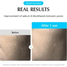 پد تونر آبرسان و تسکین‌دهنده اکوال بری EQQUALBERRY Swimming Pool Toner Pads کره‌ای دو طرفه با کمپلکس Hyal 8 و سیکا برای پوست حساس