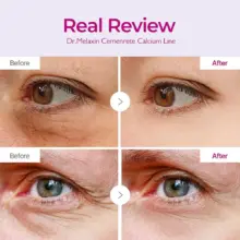 پچ زیر چشم کلسیم دکتر ملاکسین اصل مدل Cemenrete Calcium Volume Eye Patch ضد چروک روشن کننده و آبرسان