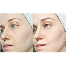 ژل شستشوی صورت سبیوم بایودرما Bioderma Sebium Gel Moussant برای پوست چرب و مختلط مستعد آکنه