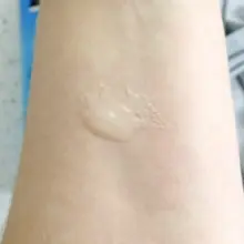 ژل-لایه-بردار-و-صاف-کننده-پوست-صورت-نیتروژنا-نوتروژینا-Neutrogena-Hydro-Boost-Exfoliator-Smoothing-Gel-150ml.