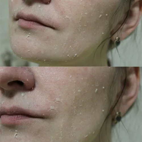 ژل-پیلینگ-شکوفه-زرد-آلو-بیوتی-اف-جوسان-Beauty-of-Joseon-Apricot-Blossom-Peeling-Gel