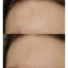کرم آبرسان و مرطوب‌کننده اوردینری Natural Moisturizing Factors اصل؛ بهترین انتخاب برای آبرسانی سبک و تقویت سد دفاعی پوست.