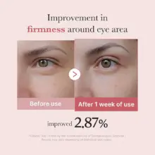 کرم دور چشم PDRN و پپتاید مدی کیوب اصل مدل Medicube PDRN Pink Peptide Eye Cream مناسب کاهش چروک دور چشم، روشن شدن تیرگی، آبرسانی و بهبود بافت اطراف چشم