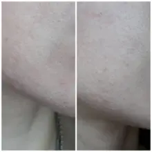 کرم مرطوب کننده و تغذیه کننده اتودرم بایودرما Bioderma Atoderm Cream Ultra برای پوست خشک و حساس