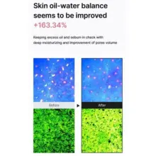 کرم-مرطوب-کننده-کنترل-چربی-سلیمکس-Celimax-Oil-Control-Moisturizing-Cream.